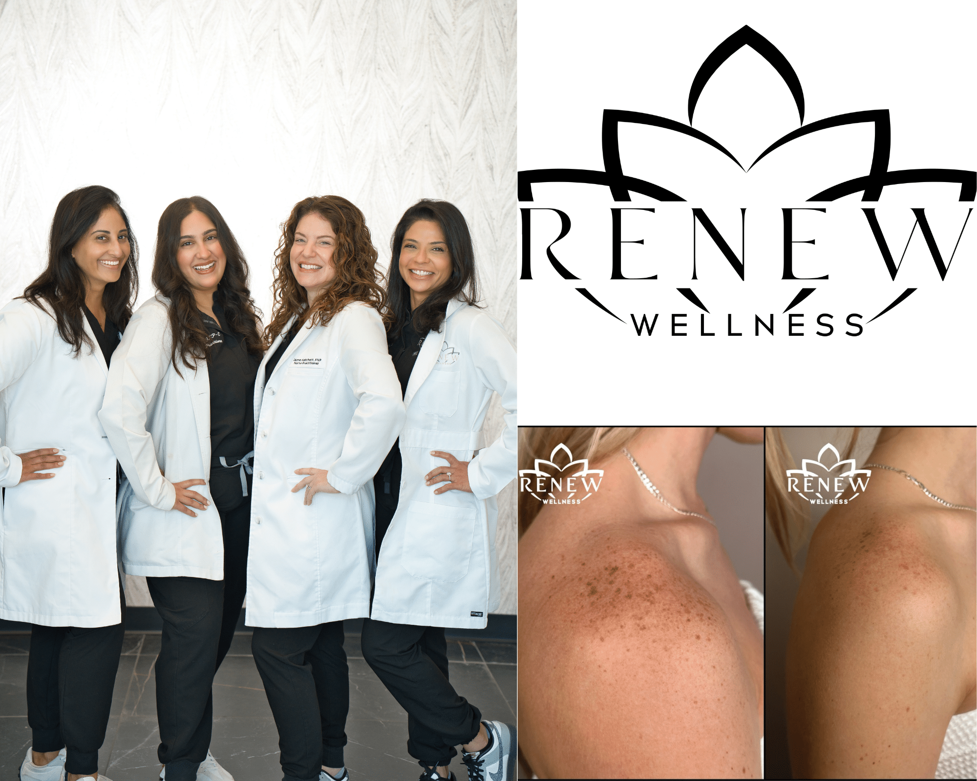 Renew Wellness